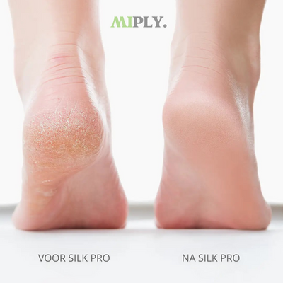 Silk Pro™ – Zachte voeten in minuten, zonder salonbezoek (inclusief 4 gratis rollers)